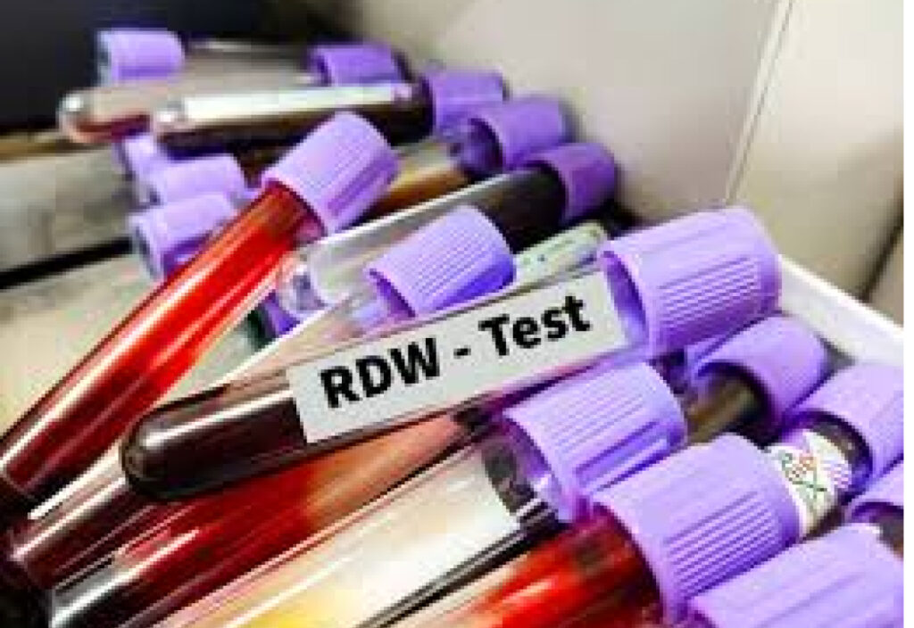 blood test rdw is high